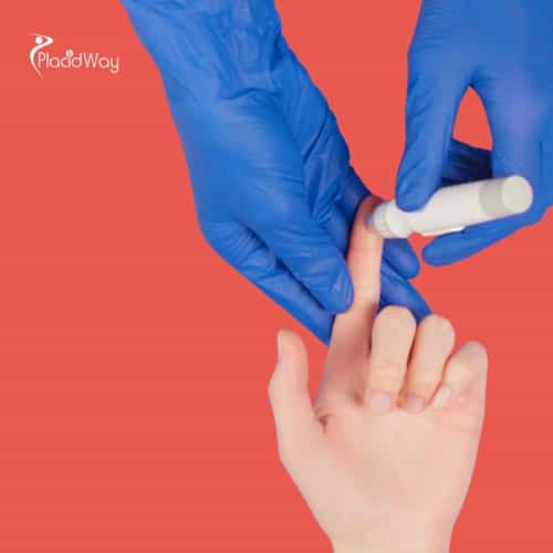 Stem Cell Therapy for Diabetes in Thailand: The Ultimate Guide for Myanmar Patients